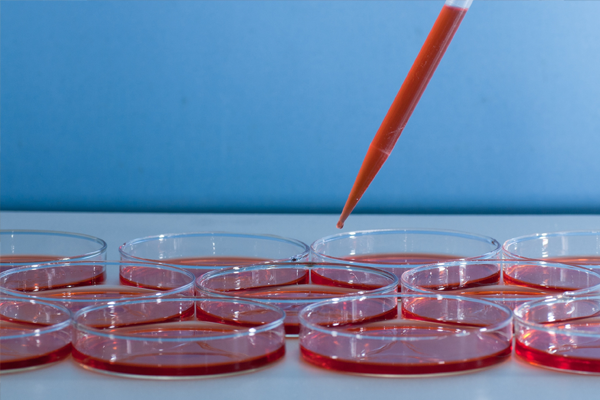 Limitations of Static Expansion Platforms Limitations of Static Expansion Platforms